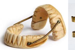 Հետաքրքիր փաստեր ստոմատոլոգիայի և ատամների մասին Ատամնաբուժությունը հին ժամանակներում